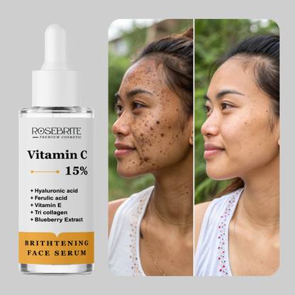 RoseBrite Glow-Boosting Vitamin C Serum – Brightens Skin Tone & Improves Skin Clarity