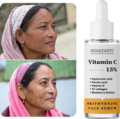 RoseBrite Vitamin C Serum with Hyaluronic Acid & Vitamin E – Smooths Fine Lines, Boosts Skin Firmness & Improves Elasticity Gently