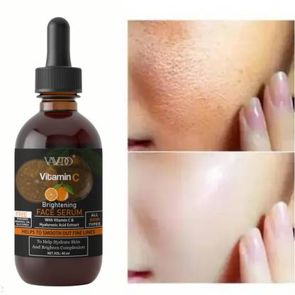 VAVEDO Vitamin C Face serum|Reduces dark spots,uneven skin tone|Brightens dull skin