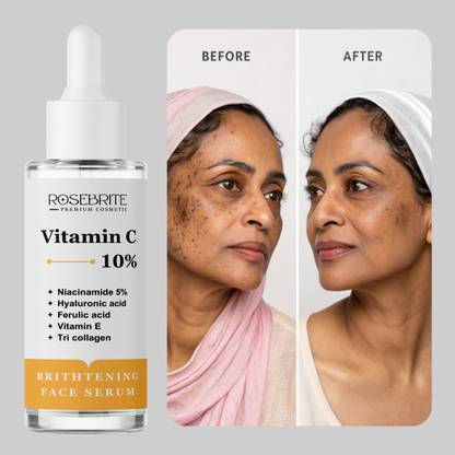 RoseBrite Skin Radiance Serum – Vitamin C, Tri-Collagen, Hyaluronic Acid, Niacinamide & Antioxidants for Glow & Firmness