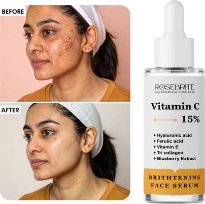 RoseBrite Brightening Face Serum with Vitamin C, Hyaluronic Acid & Ferulic Acid – Firms, Hydrates & Softens Wrinkles for Radiant Skin