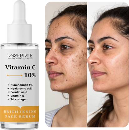 RoseBrite Vitamin C + Niacinamide Face Serum – With HA, Ferulic Acid, Vitamin E & Collagen to Hydrate, Brighten & Improve Texture