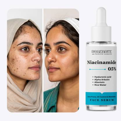 RoseBrite Skin Balancing Serum with 5% Niacinamide, Alpha Arbutin & Hyaluronic Acid – Reduces Acne Marks, Oil & Dehydration