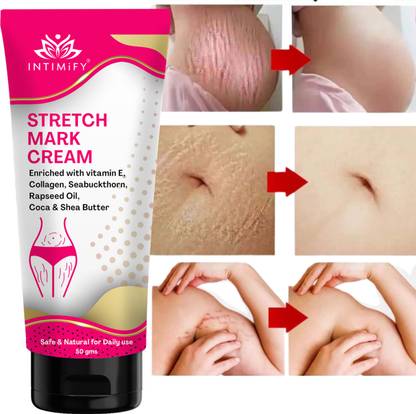 INTIMIFY Stretch Marks Cream, Scar Removal For Pregnancy