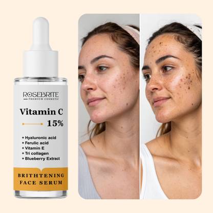 RoseBrite Glow-Enhancing Vitamin C Serum – Fights Dark Spots & Reveals Brighter, Smoother Skin