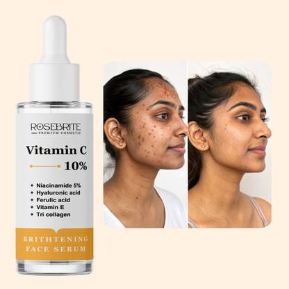RoseBrite Vitamin C Face Serum – Fights Premature Aging, Reduces Wrinkles, Hydrates & Leaves Skin Looking Smoother, Softer & More Supple