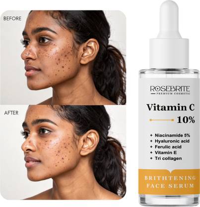 RoseBrite Bright & Clear Skin Serum – Vitamin C-Powered Formula Fights Dullness & Fades Hyperpigmentation Gently