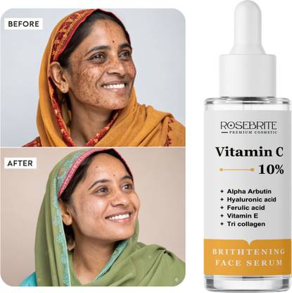 RoseBrite Advanced Spot Corrector Serum – Vitamin C Formula That Repairs, Firms & Brightens All Skin Types