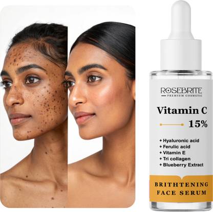 RoseBrite Advanced Brightening Serum – Vitamin C + Hyaluronic Acid, Ferulic Acid & Vitamin E to Reduce Pigmentation, Spots & Uneven Skin