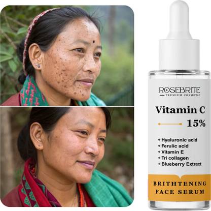 RoseBrite Advanced Vitamin C Serum – Improves Skin Elasticity, Smoothness & Brightness with Ferulic Acid, Hyaluronic Acid & Vitamin E