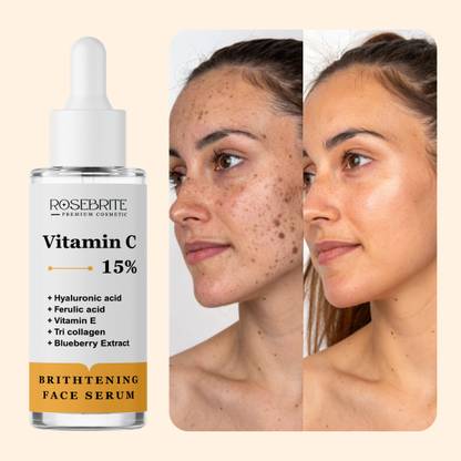 RoseBrite Vitamin C Brightening Drops – Fights Pigmentation, Dullness & Uneven Tone