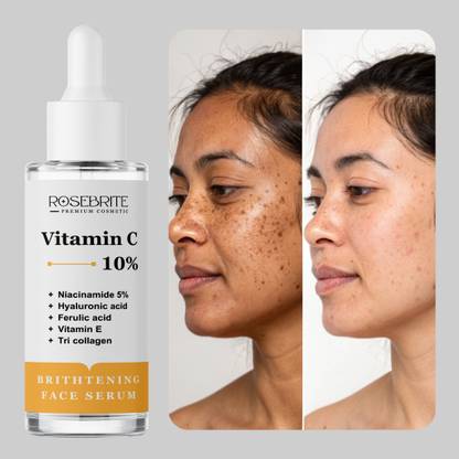 RoseBrite Vitamin C Serum – Visibly Minimizes Pores, Smooths Skin & Enhances Glow with Daily Hydration & Antioxidant Power