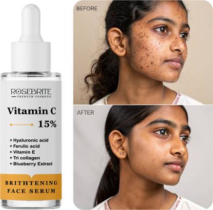 RoseBrite Vitamin C Glow Serum – Guards Against Sun Damage & Environmental Stress with Ferulic Acid, Vitamin E & Deep Hydration from Hyaluronic Acid