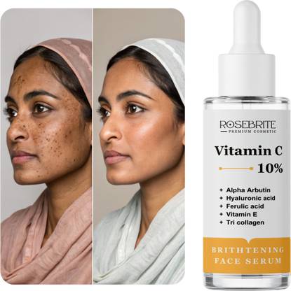 RoseBrite Vitamin C Skin Brightening Serum – Clinically Proven to Hydrate, Firm & Improve Skin Texture