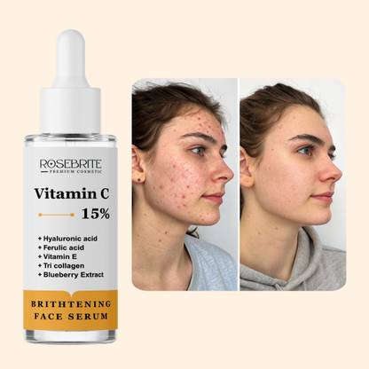 RoseBrite Vitamin C 15% Serum with Hyaluronic Acid, Ferulic Acid & Vitamin E – Brightens, Fades Spots & Boosts Collagen for Glowing Skin