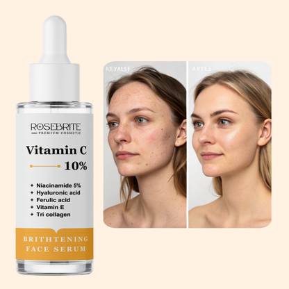RoseBrite Vitamin C Face Serum – Daily Repair for Uneven Tone, Dull Skin & Post-Acne Pigmentation Issues