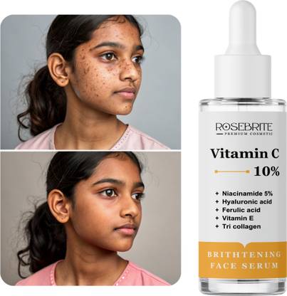 RoseBrite Vitamin C Serum – Your Daily Glow Dose for Radiant, Youthful, Clear Skin