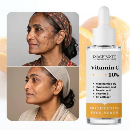 RoseBrite Vitamin C + Niacinamide Face Serum – Brightens Skin, Evens Tone & Fades Dark Spots for Clear, Glowing Complexion