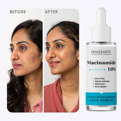 RoseBrite Niacinamide 10% Serum with Zinc PCA & Alpha Arbutin - Oil Control, Pore Minimizing & Brightening Facial Treatment for Clear Skin