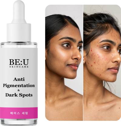 Be U Vitamin C Face Serum for Skin Brightening & Glow with Niacinamide – Dark Spot & Pigmentation Repair, Even Tone & Smooth Finish