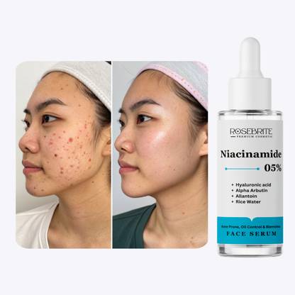 RoseBrite Moisture-Locking Face Serum That Enhances Elasticity, Reduces Fine Lines, and Plumps the Skin Surface