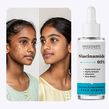 RoseBrite Pore Perfecting Face Serum – Clears and Tightens Pores, Reduces Redness & Controls Shine with Every Application