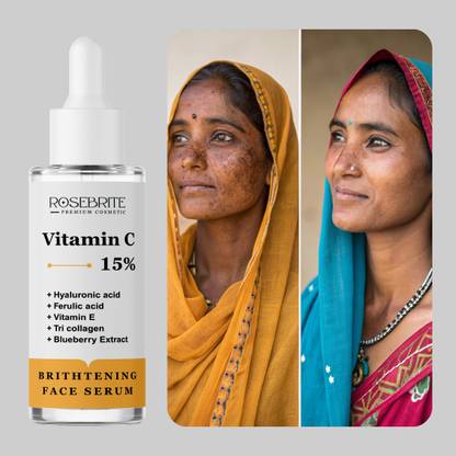 RoseBrite Vitamin C Face Serum – Daily Brightening, Anti-Aging & Skin Tone Repair Treatment
