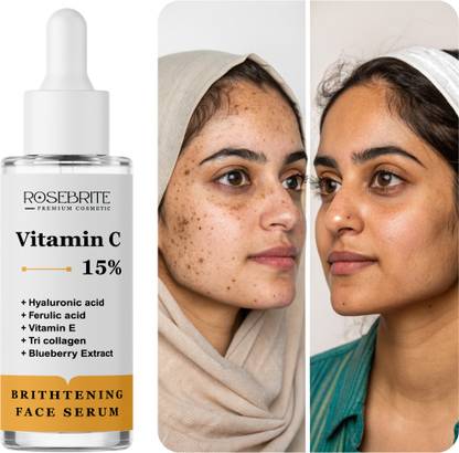 RoseBrite Clear Skin Vitamin C Serum – Hydrates, Brightens & Restores Radiant Complexion