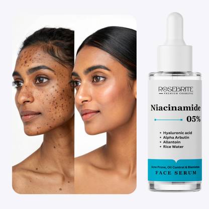 RoseBrite Skin Clarifying Serum with Niacinamide 5%, Alpha Arbutin & HA for a Glowing, Hydrated, Clear and Balanced Complexion
