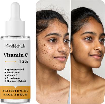 RoseBrite Anti-Aging Face Serum – With Vitamin C & Hyaluronic Acid for Hydrated, Glowing & Youthful Skin