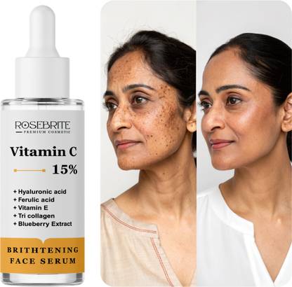 RoseBrite Glow Repair Vitamin C Serum – Targets Pigmentation, Uneven Skin Tone & Fine Lines