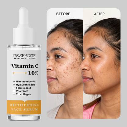 RoseBrite Daily Vitamin C Face Serum – Fights Dullness, Tightens Pores & Promotes a Glowing, Smooth, Refreshed Complexion