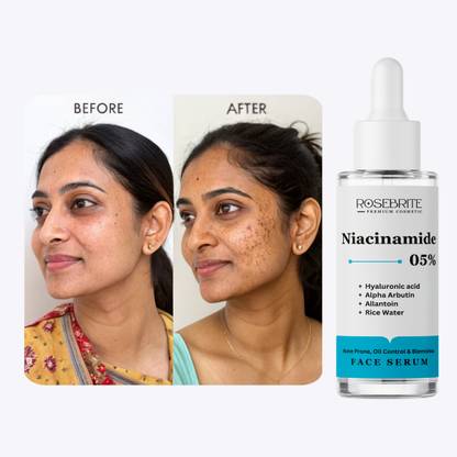 RoseBrite Rejuvenating Face Serum That Hydrates Deeply, Restores Skin Elasticity, and Diminishes Fine Lines for a Glowing Complexion