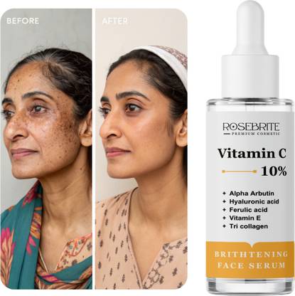 RoseBrite Vitamin C Serum for Face – Dermatologist Recommended, Clinically Proven to Brighten, Hydrate & Repair Damaged Skin