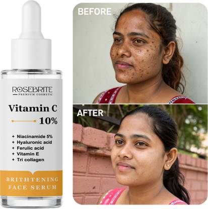 RoseBrite All-in-One Vitamin C Face Serum – Infused with Niacinamide, HA, Ferulic Acid, Vitamin E & Tri Collagen for Spotless & Plump Skin