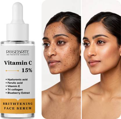 RoseBrite Vitamin C 10% Face Serum – Brightens Dull Skin, Evens Tone & Enhances Natural Glow