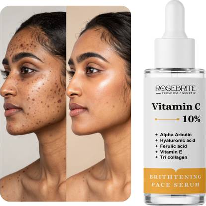 RoseBrite Advanced Vitamin C Face Serum to Reduce Blemishes, Boost Radiance, and Clarify Dull, Uneven Skin for a Glowing Complexion