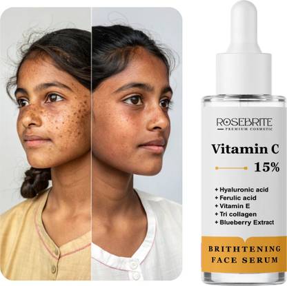 RoseBrite Vitamin C Serum – For Smooth, Firm, Radiant Skin with Hyaluronic Acid, Ferulic Acid & Vitamin E – Daily Anti-Aging Solution