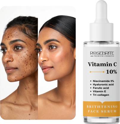 RoseBrite Hyperpigmentation Fade Serum – With Vitamin C to Revitalize Dull Skin, Brighten Tone & Soften Skin Texture