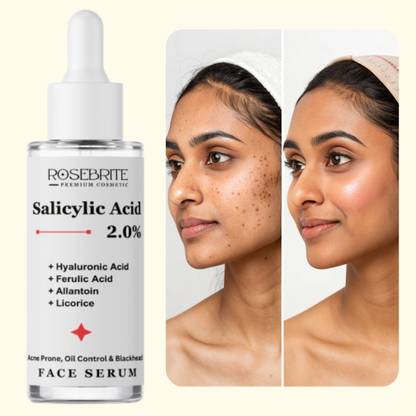 RoseBrite Anti-Breakout Face Serum with Salicylic, Hyaluronic, Ferulic Acid, Allantoin & Licorice – Clears Pimples & Strengthens Skin