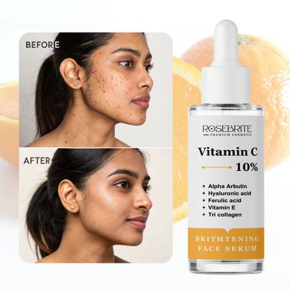 RoseBrite Skin Perfecting Face Serum – With Vitamin C to Brighten, Clarify & Smooth Uneven Skin Tone Gently