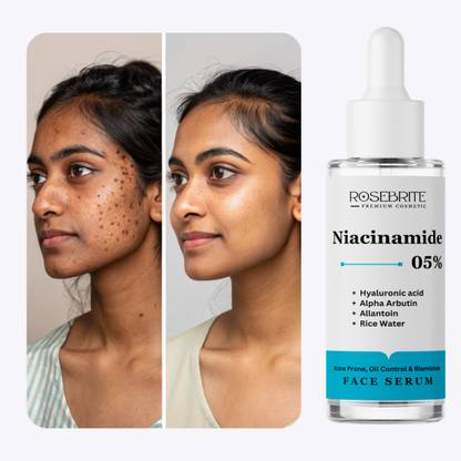 RoseBrite Multi-Correction Serum – Niacinamide 5%, Alpha Arbutin & Hyaluronic Acid for Brightening, Hydrating & Repairing Skin