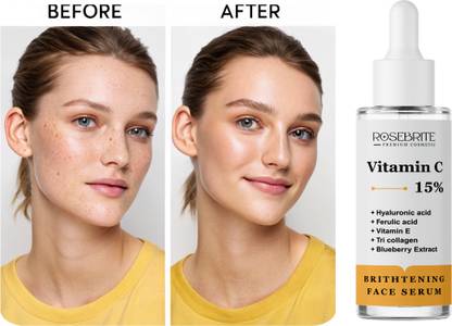 RoseBrite Vitamin C 15% Facial Serum – Reduces Fine Lines, Boosts Glow & Hydrates Skin with Vitamin E, Ferulic Acid & Hyaluronic Acid