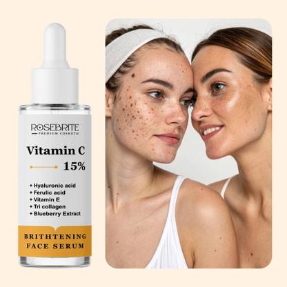 RoseBrite Vitamin C Serum – Skin Brightening & Spot Reduction in One Daily Formula