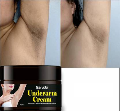 Garuda Intimate Area Dark Spots Corrector Cream For Skin Lightening, Fairness
