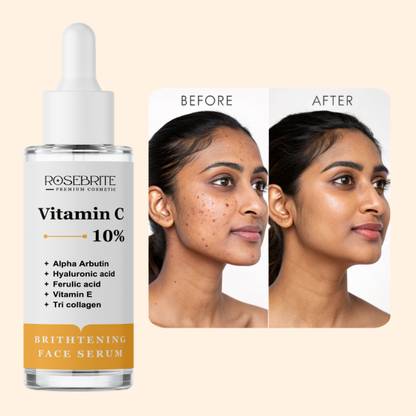 RoseBrite Anti-Pigmentation Vitamin C Serum – Fades Melasma, Freckles & Dark Patches While Boosting Skin’s Natural Radiance