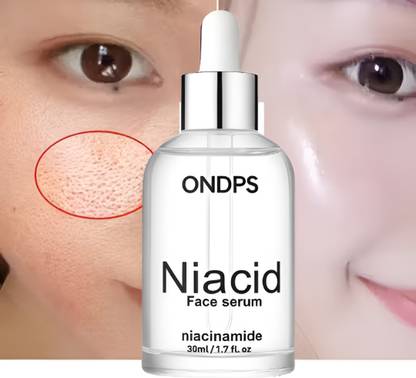 ONDPS niacinamide serum - Niacid Face Serum for Open Pores & Dark Acne 2.0