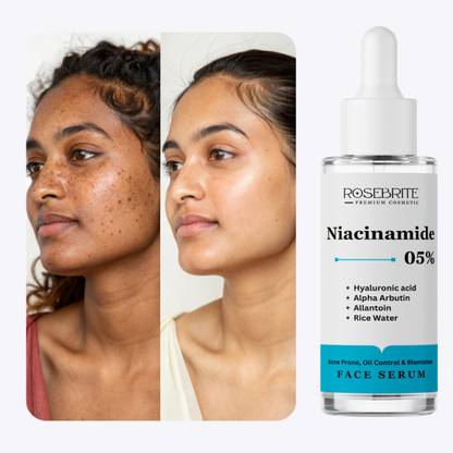 RoseBrite Calm & Clear Face Serum – Reduces Pore Size, Regulates Sebum & Fights Redness with Gentle Ingredients