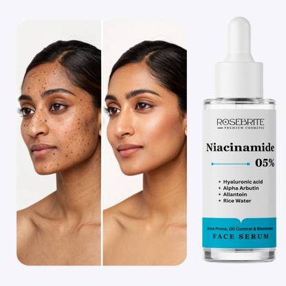 RoseBrite Glow Booster Face Serum with Niacinamide 5%, Alpha Arbutin & Hyaluronic Acid – Reduces Pigmentation, Oil & Dryness