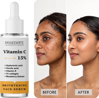 RoseBrite Skin Brightening Serum with Vitamin C – Evens Tone, Fades Pigmentation, and Softens Skin